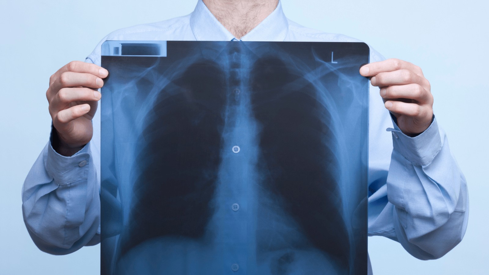 Radiology CPT Codes 2024