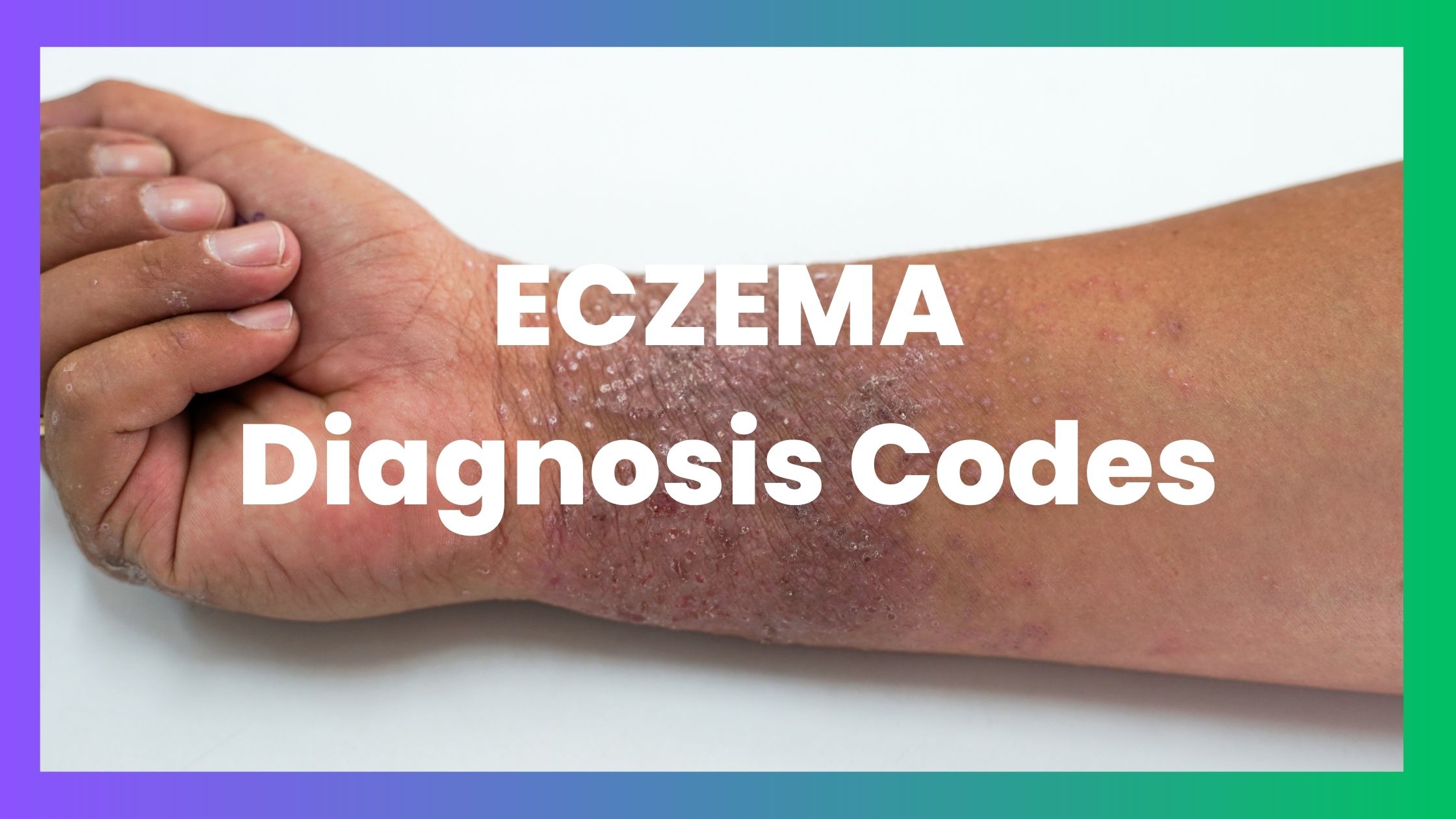 Eczema icd 10 codes and Dermatitis codes are from (L20-L30)