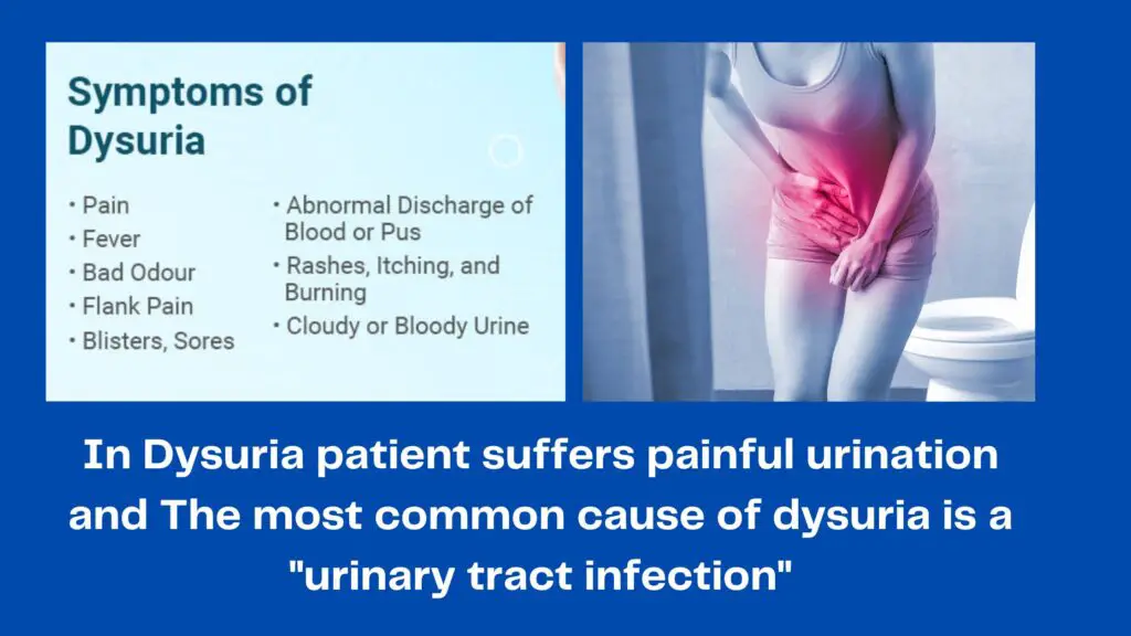 Dysuria diagnosis codes/icd 10 code dysuria