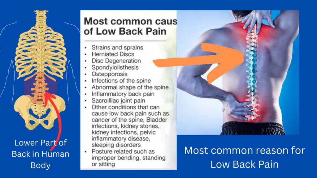 Most common reason for low back pain in human body