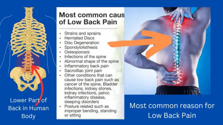 ICD 10 Code For Low Back Pain